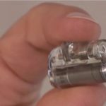 اسپین میں دنیا کا سب سے چھوٹا پیس میکر لگا کر 2.1 کلو وزنی نومولود بچی کی جان بچا لی گئی